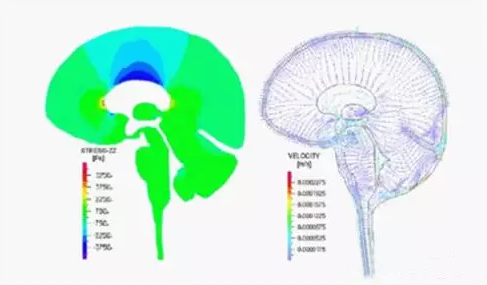 有限元在生物醫(yī)療三維人體建模方面的應用